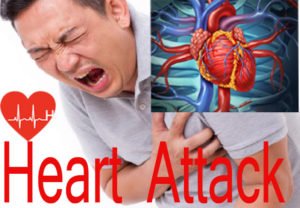 heart-attack-causes-symptoms