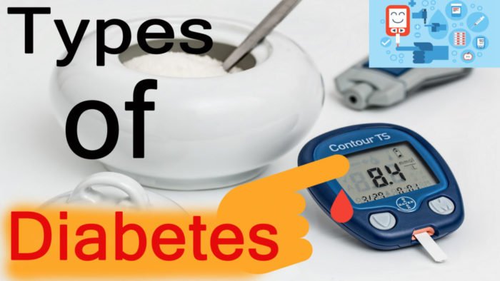 types-of-diabetes