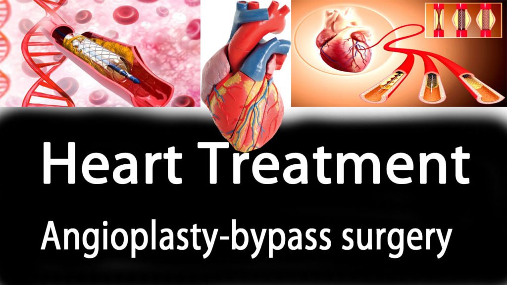 heart-treatment-angioplasty-bypass-surgery