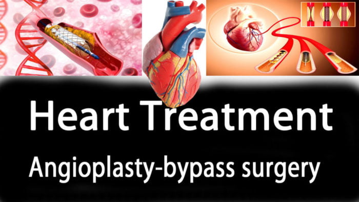 heart-treatment-angioplasty-bypass-surgery