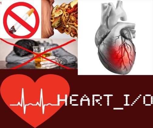 HEART ATTACK TREATMENT IN INDIA-A heart attack (Myocardial Infarction (MI) or Acute Myocardial Infarction (AMI)) is the interruption of blood supply to a part of the heart which causes heart cells to die.